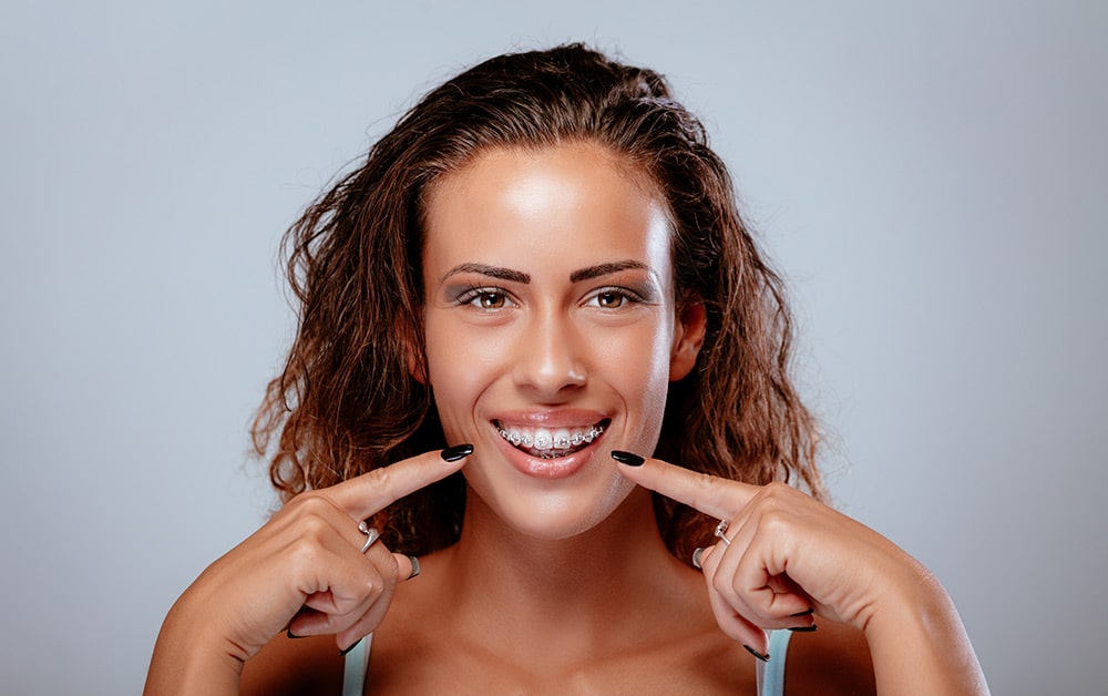 BEST Adult Braces and Cost Factors How Much Do Adult Braces Cost?