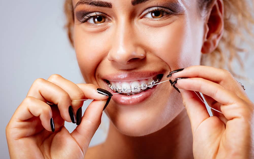 flossing your braces - - how to care for braces miami lakes